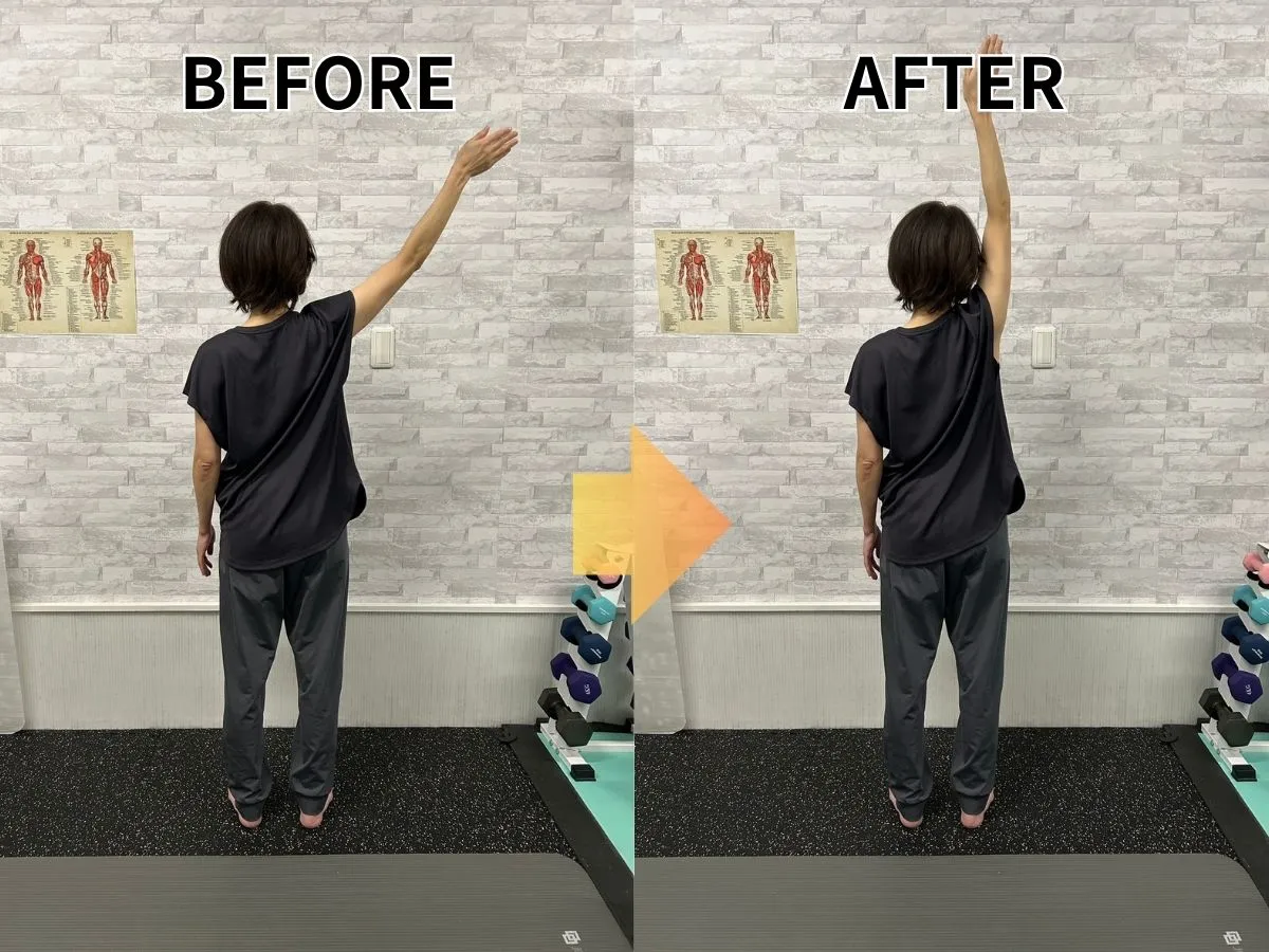 肩の柔軟性ビフォーアフター｜四十肩・五十肩改善