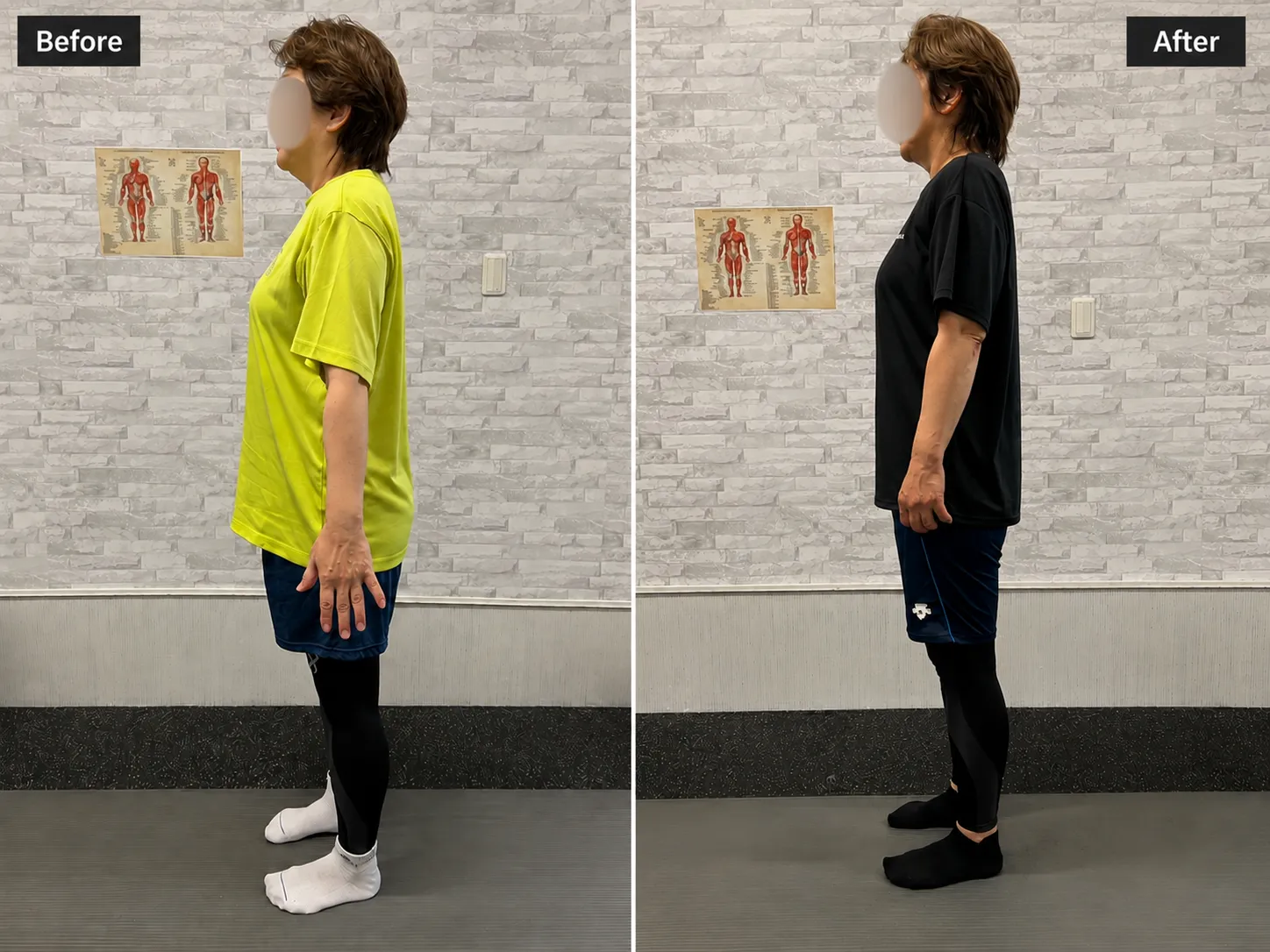 札幌市西区発寒のキースタイルフィットネスで60代女性が4カ月で体重−6.4kg、ウエスト−11cmとなったビフォーアフター